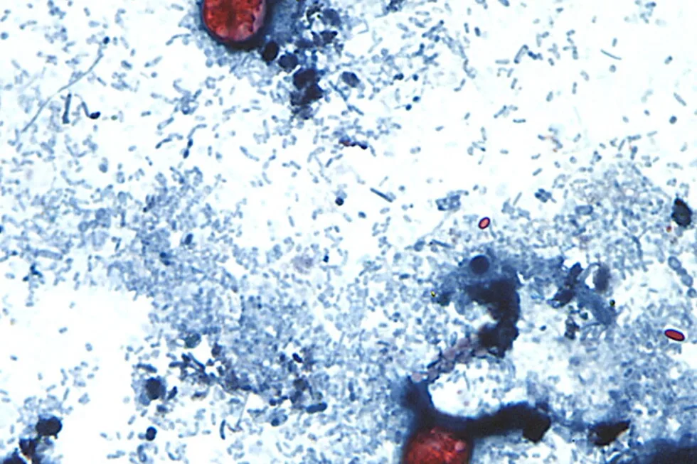 Parasite outbreak tops 1,000 cases in Michigan